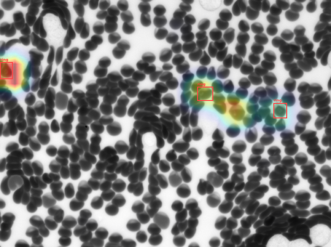 Malaria ring-stage