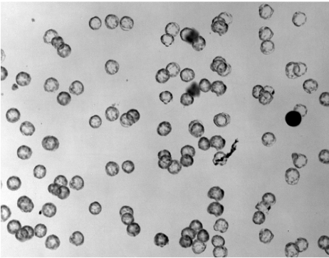 CSF cells under Remoscope