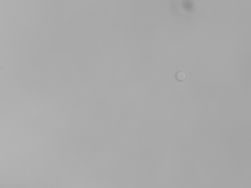 Cerebrospinal fluid