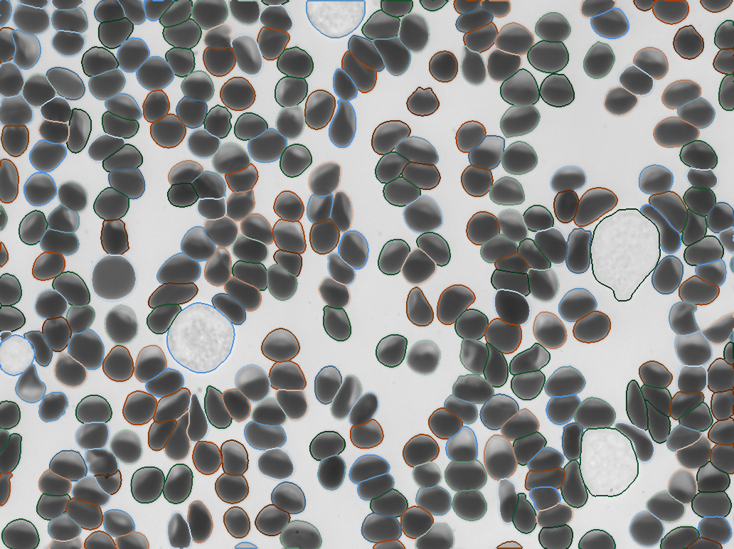 Instance segmentation
