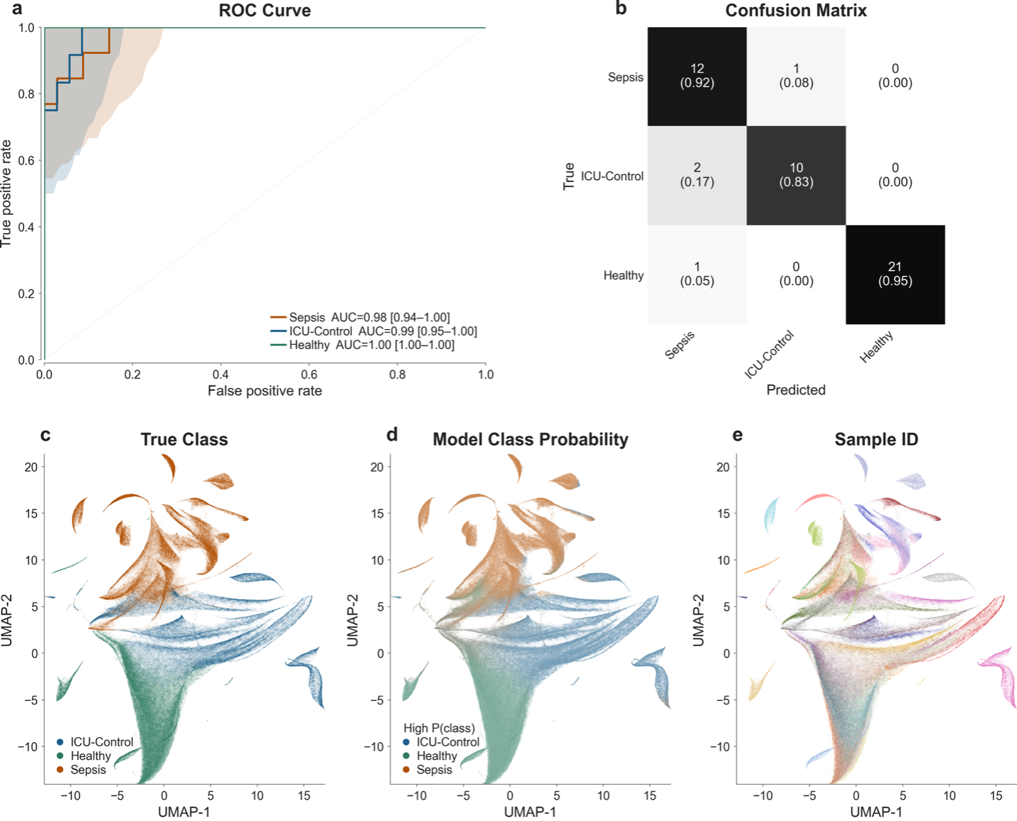 Sepsis classification: ROC curves, confusion matrix, and UMAP embeddings